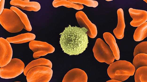 Cellulose Nanogenerators May Power Medical Implants