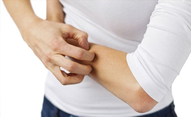 Allergies: Heres Why You Should Take Them Seriously