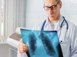 Singapore Hospital Recalls 178 Children for Tuberculosis Tests Singapore Hospital Recalls 178 Children for Tuberculosis Tests