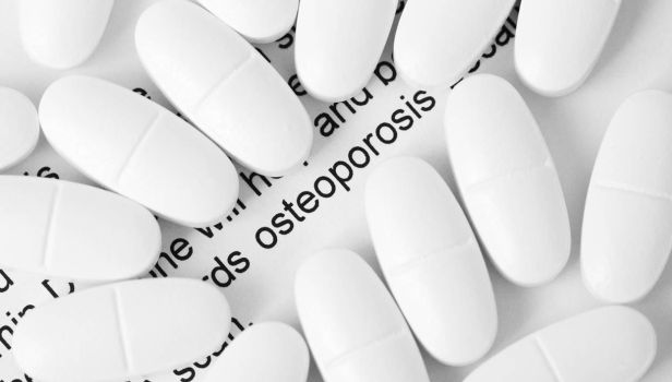 All About Osteoporosis: The Role of Calcium, Vitamin D and Regular Exercise
