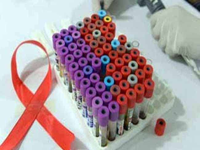 Japanese Scientists Discover HIV Inhibiting Protein