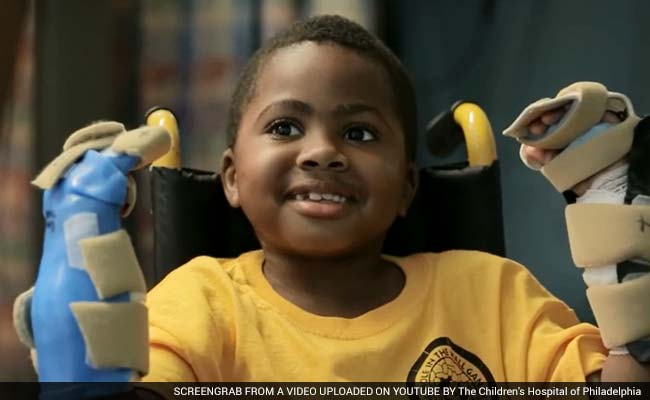 First Child Double Hand Transplant Announced in US