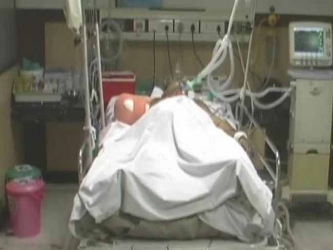 यूपी पुलिस ने बिना सोचे-समझे चला दी गोली और गंवाना पड़ा इस युवक को अपना हाथ