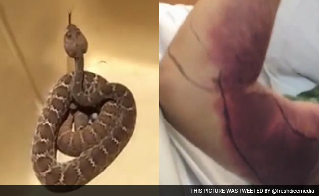 He Posed For Selfie With a Deadly Rattlesnake. It Cost Him $150,000.