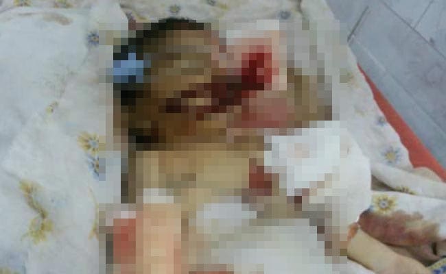 आंध्र के अस्पताल में कथित तौर पर चूहों के काटने से बच्चे की मौत