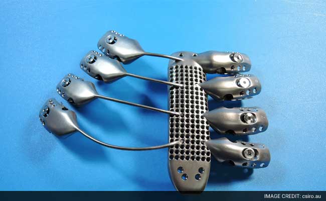 Cancer Patient Receives 3D Printed Ribs in World First Surgery