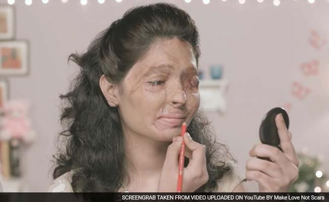 With Red Lipstick, Indian Acid Attack Victim Makes a Bold Statement