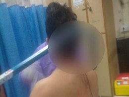 लुटेरों के वार से तीन फीट लंबी रॉड हुई सिर के आर-पार, डॉक्टरों ने ऑपरेशन से निकाली लुटेरों के वार से तीन फीट लंबी रॉड हुई सिर के आर-पार, डॉक्टरों ने ऑपरेशन से निकाली