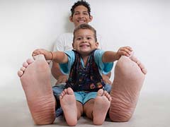 Man With World's Largest Feet Receives Welcome Gift