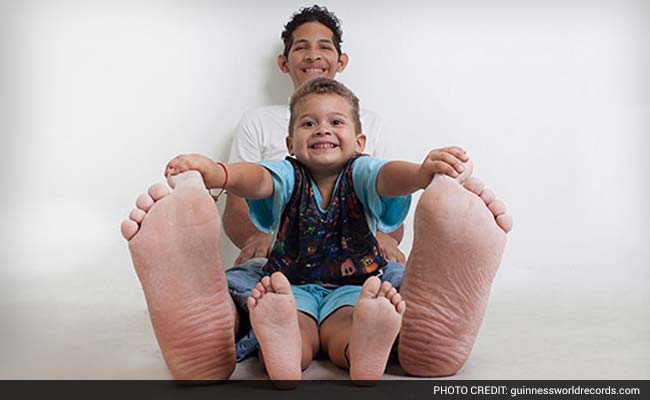 Man With World's Largest Feet Receives Welcome Gift