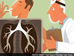 Lung Screening May Not Push Smokers to Quit