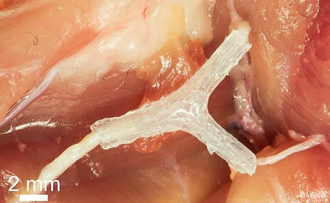3-D Printed Guide Helps Regrow Nerve After Injury