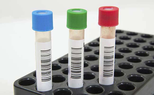 शोधकर्ताओं को जंतु की एक नई प्रजाति में मिला दुनिया का सबसे पुराना स्पर्म