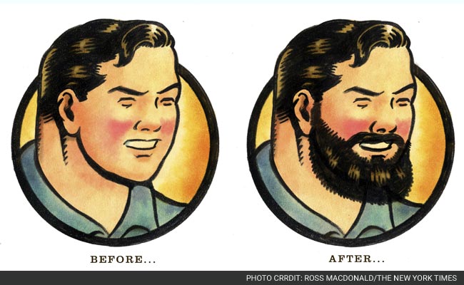 Baby-Faced Men Opt for Beard Transplants