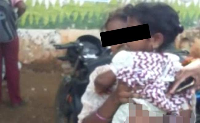 4-Year-Old Made to Sit on Hot Iron Slide as Punishment, Severely Burnt