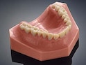 Bacteria-Fighting 3-D-Printed Teeth Could Affect Dentistry