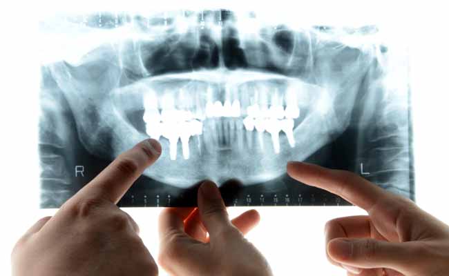 Humans May One Day Regrow Their Own Teeth