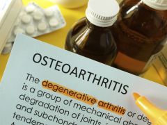 Aching Joints in Younger People May be Early-Onset Arthritis