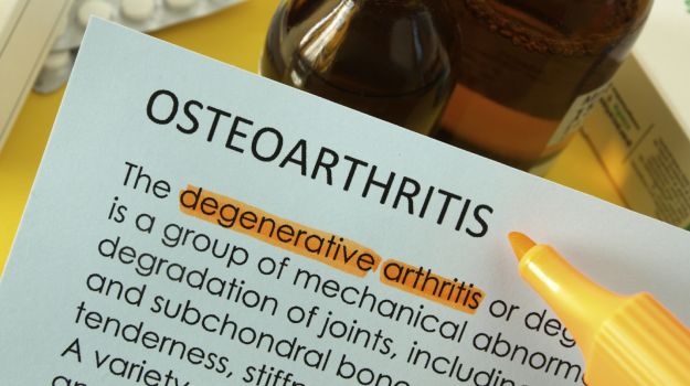 Aching Joints In Younger People May Be Early-Onset Arthritis