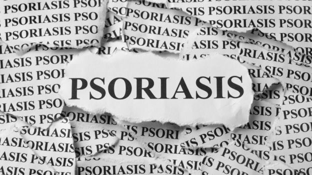 Skin Psoriasis Linked to Higher Cardiovascular Risk