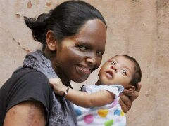 Acid Attack Survivor Laxmi Now Turns Mother