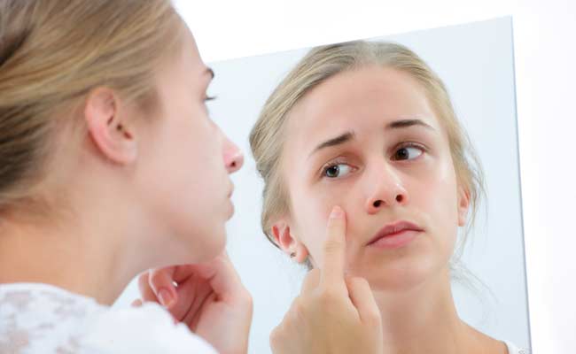 Here's How Excessive Salt Consumption Affects Skin Here's How Excessive Salt Consumption Affects Skin