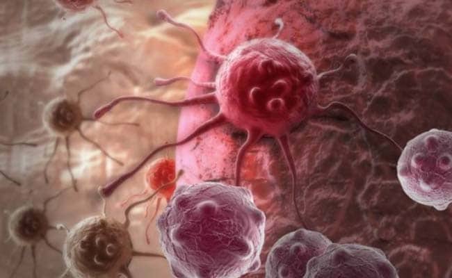 Breast Cancer Awareness Month: क्या है 'बीआरसीए टेस्ट' जिसकी मदद से ब्रेस्ट कैंसर से बचा जा सकता है Breast Cancer Awareness Month: क्या है 'बीआरसीए टेस्ट' जिसकी मदद से ब्रेस्ट कैंसर से बचा जा सकता है