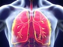 Lung Disease Could Lead To Dementia In Later Life: Study