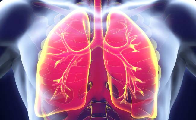 Middle-Aged At Higher Risk Of Advanced Lung Cancer: Study