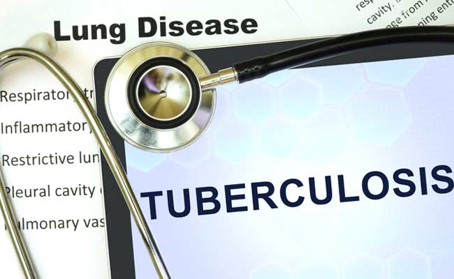 Government To Carry Out Nationwide Survey On Tuberculosis After 6 Decades