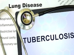 Ancient Chinese Medicine Can Help Fight Tuberculosis: Study Ancient Chinese Medicine Can Help Fight Tuberculosis: Study