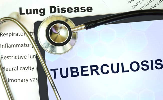 New Biomarkers Offer Hope For Effective Tuberculosis Vaccine