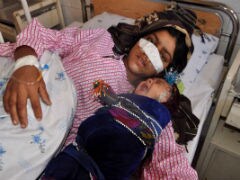 Afghans Revolted After Husband Cuts Off Wife's Nose