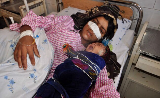 Afghans Revolted After Husband Cuts Off Wife's Nose