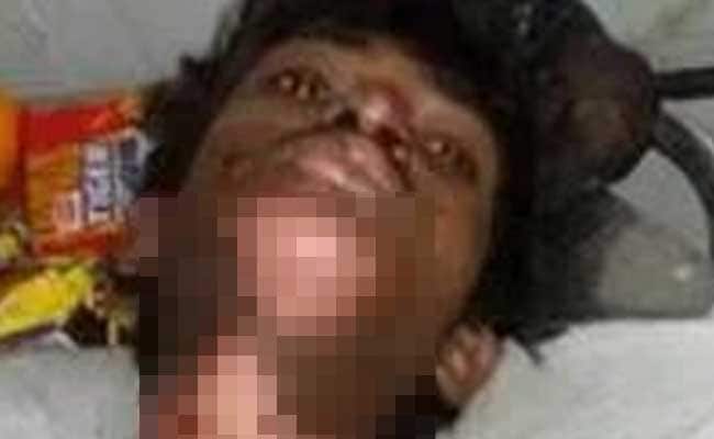 'My Son Was Burnt Alive Because He Was Hindu', Alleges Pune Teen's Father