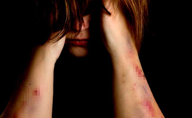 Self-Harm At Australia Detention Centres Once Every 2 Days: Reports