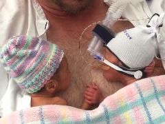 Premature Newborn Twins Hold Hands in Video Gone Viral