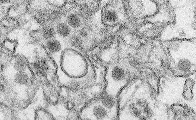 Race For Zika Vaccine Gathers Momentum As Virus Spreads