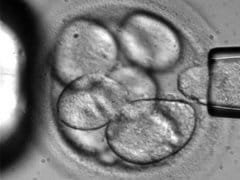 Britain Grants First Licence For Genetic Modification Of Embryos