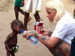Photos Of Starving 'Witch' Toddler Inspire Massive Donations