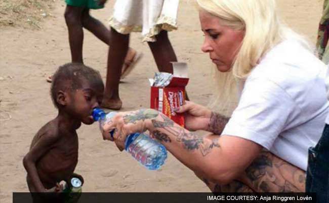 Photos Of Starving 'Witch' Toddler Inspire Massive Donations