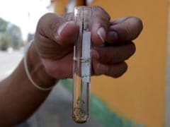 Indian Scientists Were Aware Of Zika Virus In 1950s: Research Body Chief