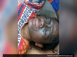 छत्तीसगढ़ : आम आदमी पार्टी की नेता सोनी सोरी पर हमला, चेहरे पर ग्रीस पोता छत्तीसगढ़ : आम आदमी पार्टी की नेता सोनी सोरी पर हमला, चेहरे पर ग्रीस पोता