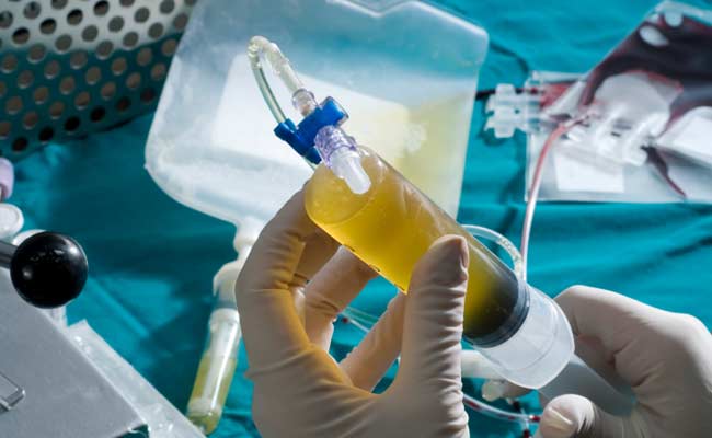 Blood Cancer Girl Gets 50 Pc Matched Bone Marrow Transplant