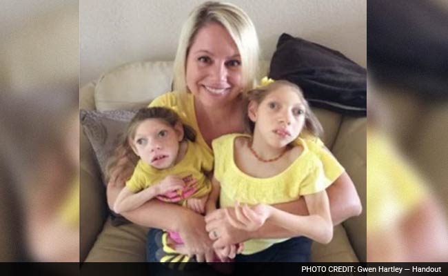 What This Amazing Mom Of Two Girls With Microcephaly Has To Say About Zika Scare