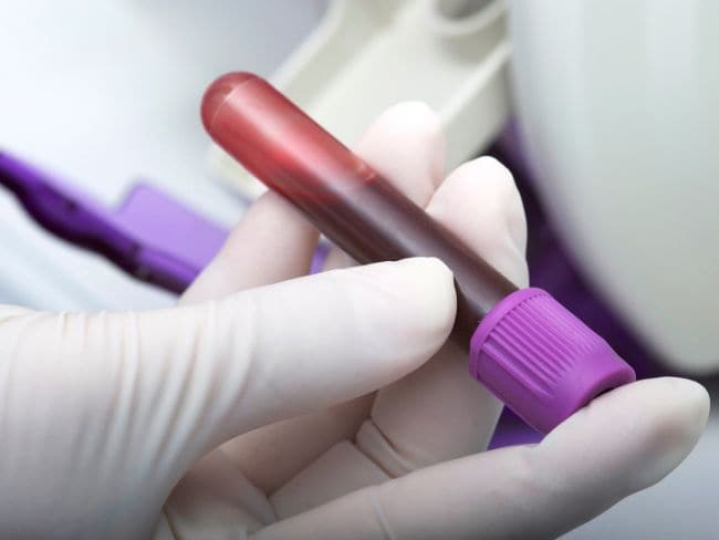 New Technique For Quick Blood Test Results Could Help Emergency Patients