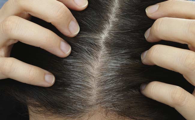 Study Finds First Gene For Greying Hair: Study