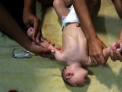 Brain Scans Of Microcephalic Babies Suggest Zika Disrupts Development