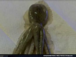 2-Year-Old Found With Octopus In Throat, Police Arrest Mother's Boyfriend: Report 2-Year-Old Found With Octopus In Throat, Police Arrest Mother's Boyfriend: Report
