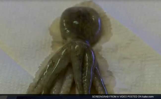 Toddler Found Unable To Breathe - With Dead Octopus Lodged In His Throat